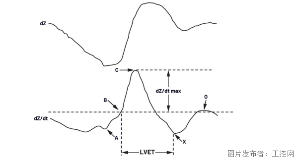 利用集成式AFE实现无创心搏出量监测(图1)