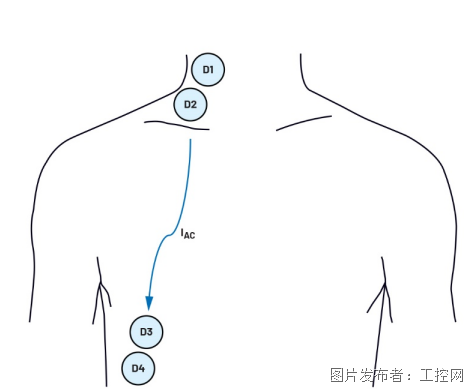 利用集成式AFE实现无创心搏出量监测(图3)