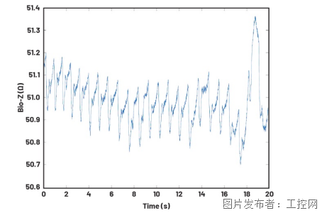 利用集成式AFE实现无创心搏出量监测(图9)