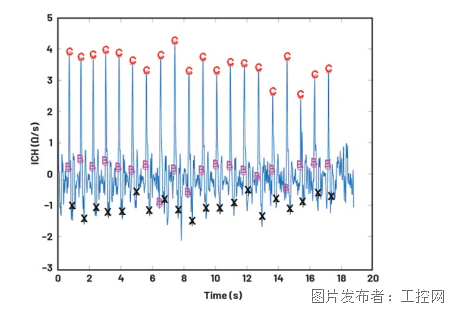 利用集成式AFE实现无创心搏出量监测(图10)
